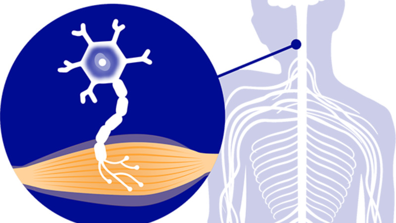 Read more about the article Understanding ALS: Exploring the Incurable and Debilitating Disease